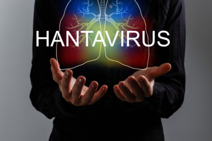 Le navire de croisière MV Hondius, au centre d’une enquête de l’OMS après plusieurs cas d’infection à hantavirus liés au virus Andes.