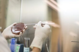 Face à la hausse des IST en Europe, brisons le silence et le jugement. Intensifier le dépistage et lever les tabous est une urgence humaine et sanitaire.